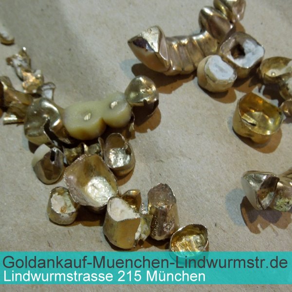 Wir kaufen auch Ihr ungereinigtes Zahngold, Dentlgold und Bruchgold.